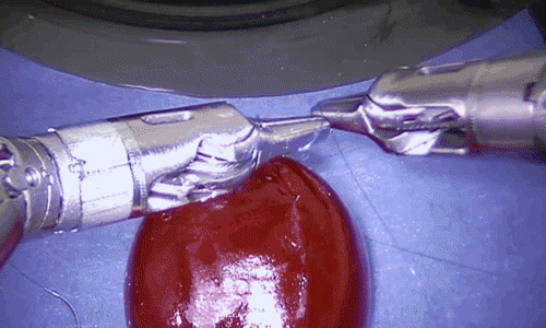 WATCH NOW! – Robot Arms Stitch a Grape!